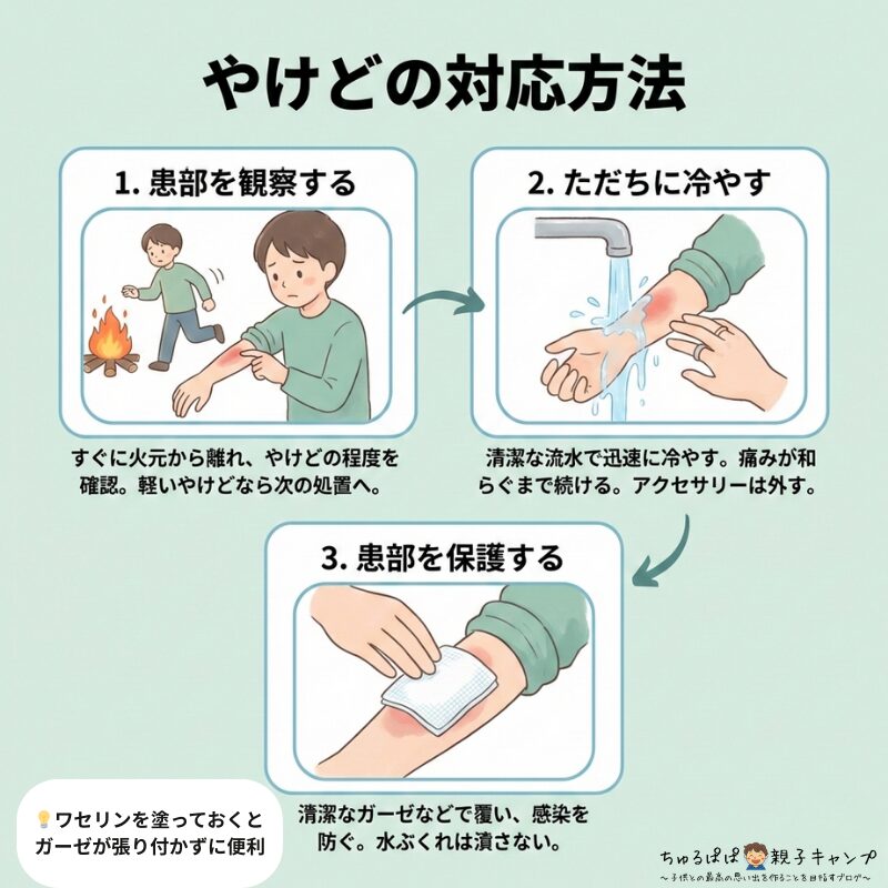 やけど対応を説明した図解