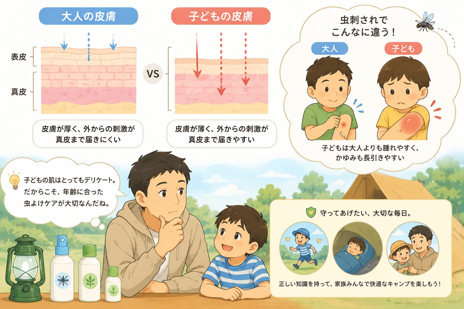 子どもの皮膚が大人より刺激に弱く虫刺されで腫れやすいことを解説する図解