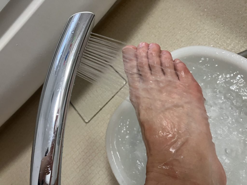 ムカデに噛まれた部分を流水で洗う様子。